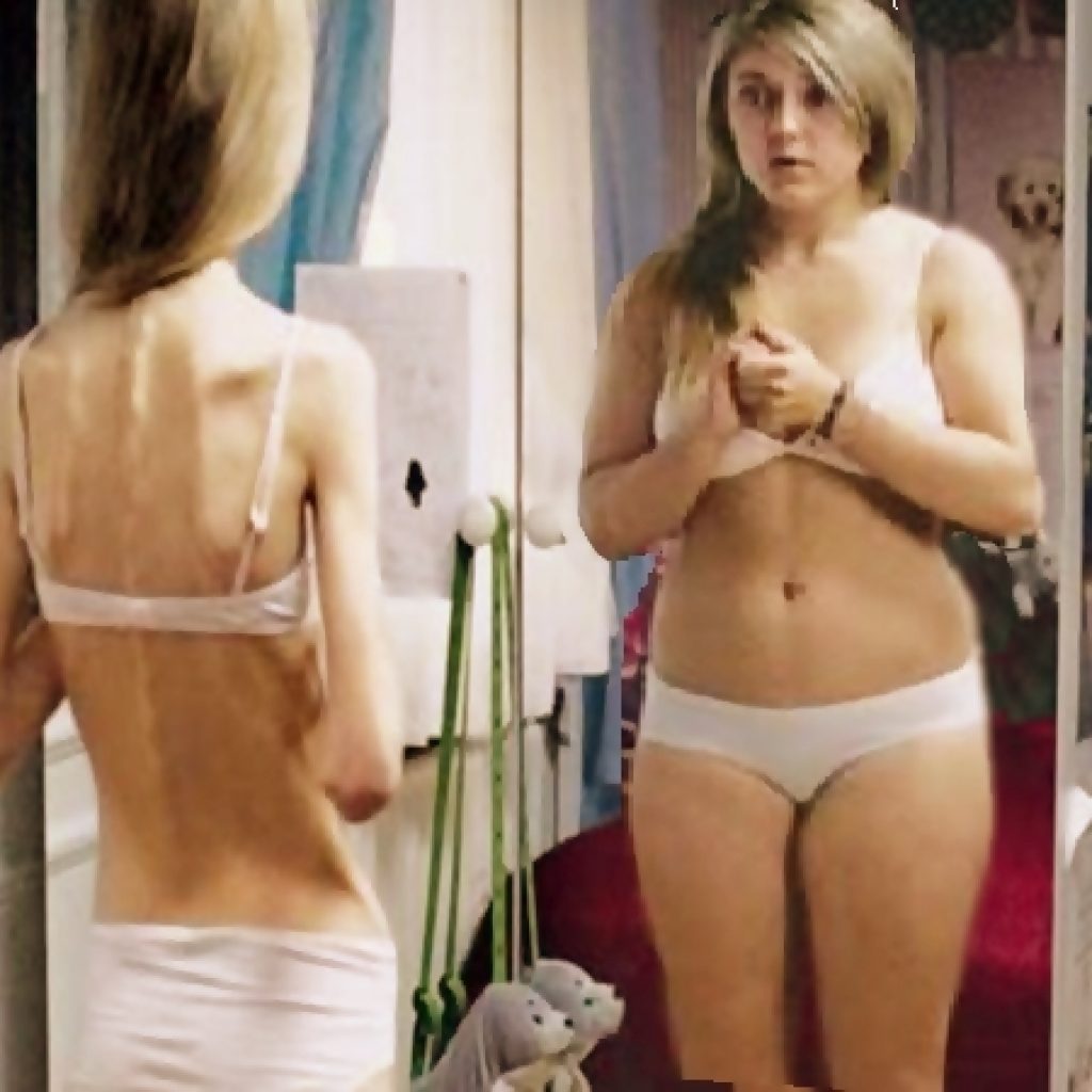 bulimia-585